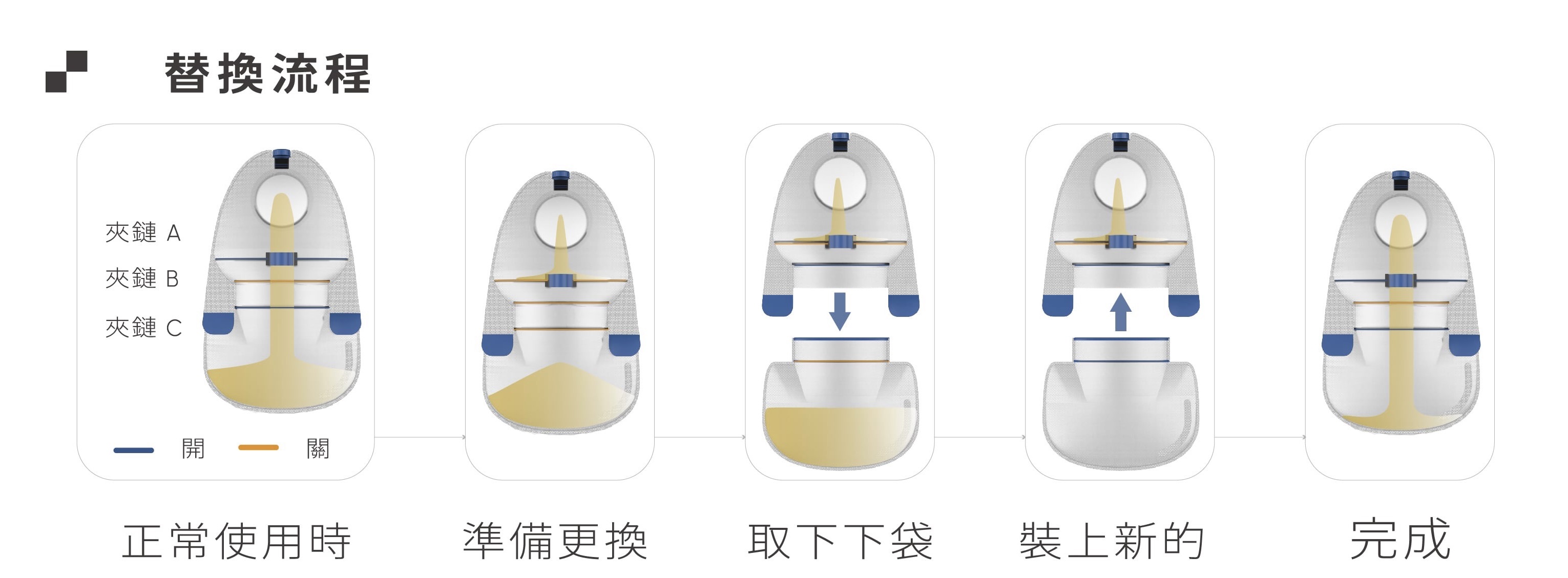 造口袋使用模組化設計讓患者可依使用情境自行組裝，共有三個夾鏈，患者能在密封狀態更換下袋。　圖／陳柏瑞提供