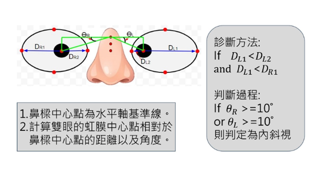 虹膜中心判斷法計算虹膜中心與眼角眼尾的距離、和鼻樑中心點的夾角，距離不等或夾角大於10度可能為斜視。圖／團隊提供