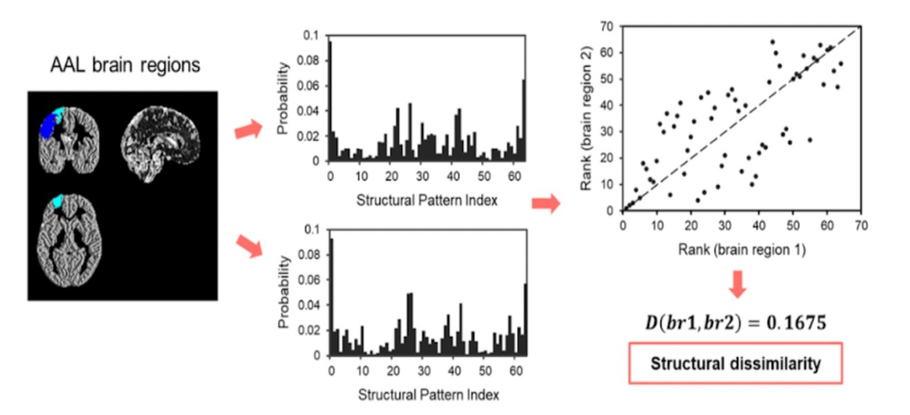 團隊進一步將上述數學模型的概念套用至大腦結構，比對健康者與阿茲海默氏症患者的差異。　圖／團隊提供