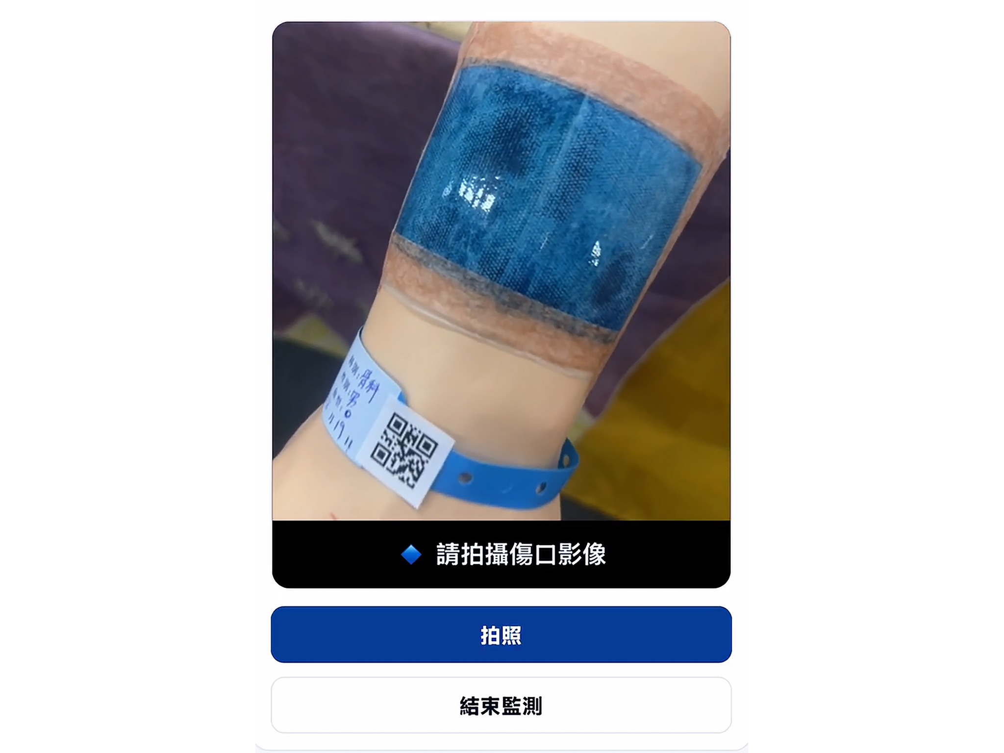 農漁廢棄物蛻新生　智慧醫療敷料促永續